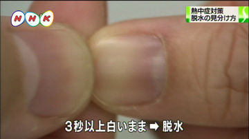 熱中症予防